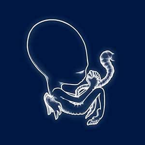 Sigur Rós - Ágætis Byrjun (2 LP) - Sigur Rós | VinylStation Radio